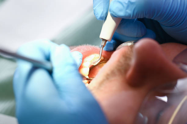 Best Broken or Cracked Tooth Emergency Dentist in Lyons, NJ