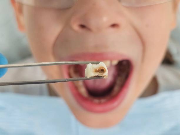 Best Pediatric Emergency Dentist in Lyons, NJ